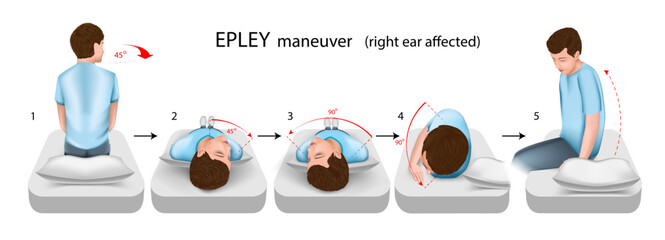 Epley maneuver right ear affected vector illustration