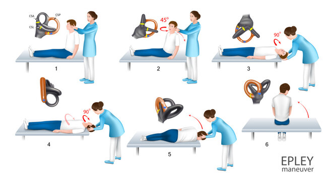 Epley maneuver is performed help of a doctor