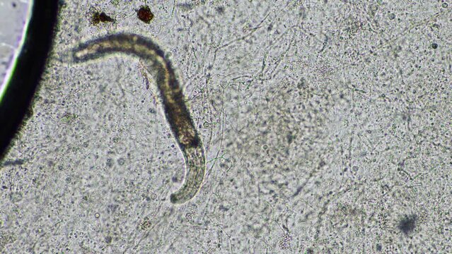 nematodes in a sample in australia 