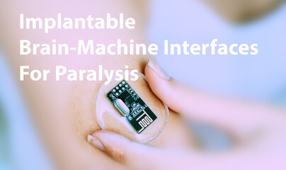 Implantable Brain-Machine Interfaces For Paralysis Implantable Electronic Medical Devices Concept