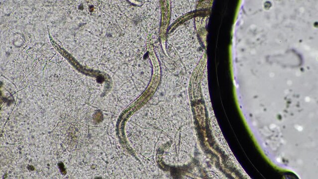 nematodes and fungi under the microscope.