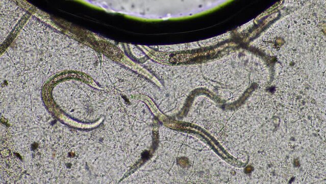 nematode  in a soil and compost sample on a farm in Australia