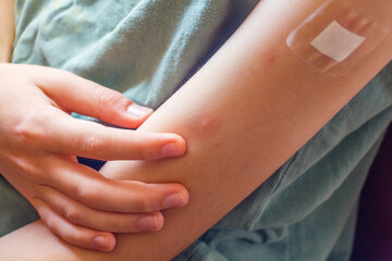 Boy's hand scratching an itching bitten by mosquito skin. Close-up view