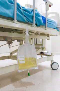 Urine bag hanging under patient bed in room at hospital. The doctor treats by giving diuretics. Medical care equipment.