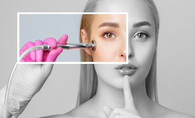 Beautiful young blonde woman with clean fresh skin naked shoulders holds a nozzle for microdermabrasion in her hands.She will do cosmetic procedure microdermabrasion.Aesthetic cosmetology.