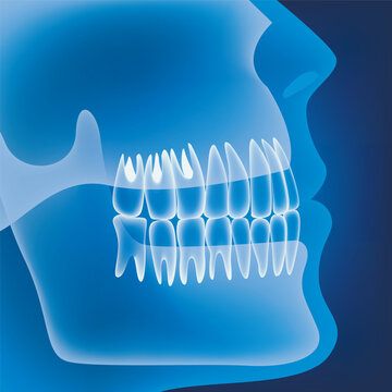 Medical poster with human jaws and teeth. Neon background. Vector illustration