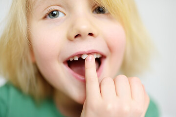 Naklejka premium Portrait of boy shaking wobbly milk tooth in open mouth before it changes to the molar. Stages of growing up a child. Health care and dental hygiene for baby.