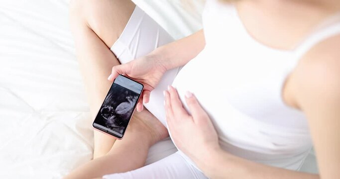 Pregnant woman looking at ultrasound picture of fetus in phone closeup 4k movie slow motion. Expectation of child happiness of motherhood concept