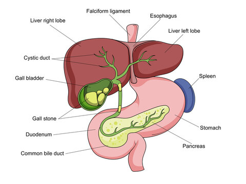 Gallstone structure stone gallbladder diagram schematic raster illustration. Medical science educational illustration