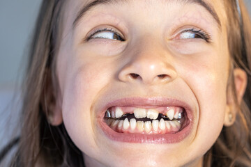Child during orthodontist visit and oral cavity check-up.