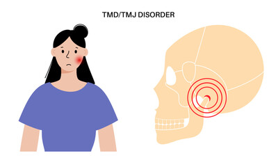 TMD TMJ disorder - 621961168