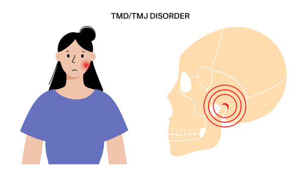 TMD TMJ disorder