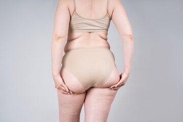 Overweight woman with fat back, hips and buttocks, obesity female body on gray background