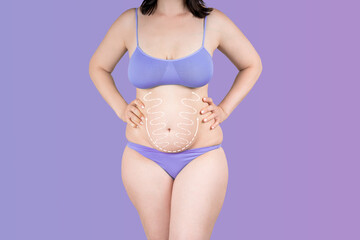 Abdomen liposuction, fat and cellulite removal concept, overweight female body with painted...
