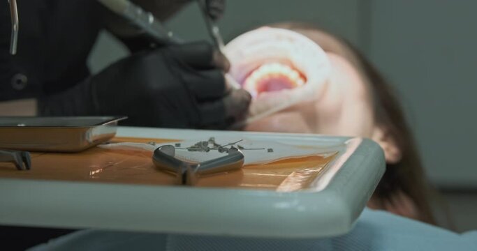 Removed steel braces, treatment dentist. Hands orthodontist in gloves treat teeth.