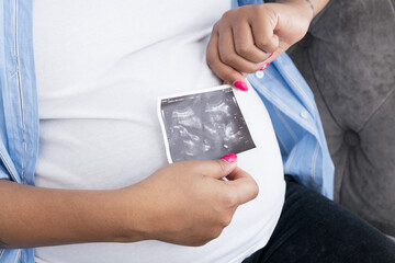Pregnancy concept, woman holding ultrasound image.