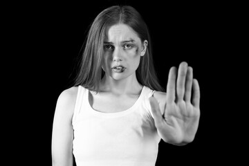 Bruised young woman showing stop gesture on dark background. Domestic violence concept
