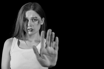 Bruised young woman showing stop gesture on dark background. Domestic violence concept - obrazy, fototapety, plakaty