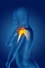 3D render of a female medical figure holding shoulder in pain