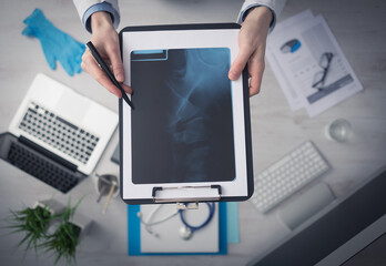 Radiologist cheching an x-ray image of human spine, hands and clipboard close up with desktop on...