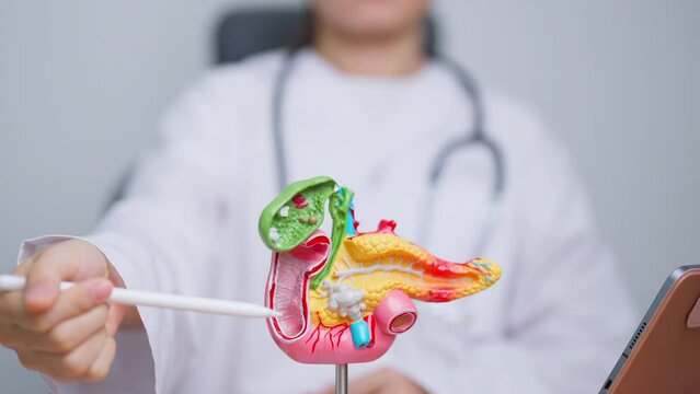 Doctor with human Pancreatitis anatomy model with Pancreas, Gallbladder, Bile Duct, Duodenum, Small intestine. Pancreatic cancer, Acute and Chronic pancreatitis,  Digestive system and Health concept
