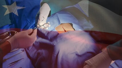 Animation of flag of chile over diverse surgeons operating - Powered by Adobe