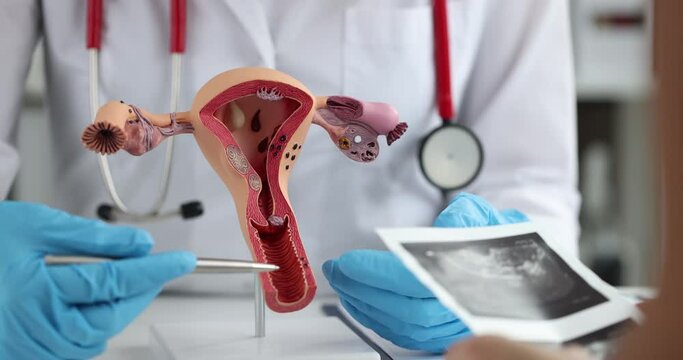 The doctor points with a pen to the anatomical model of the female reproductive system. Pregnancy planning