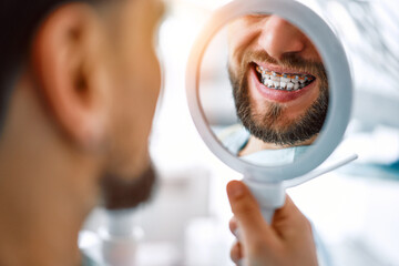 Cropped close-up image. A man with braces is holding a mirror looking at his teeth and smiling....