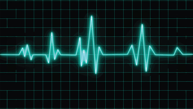 Electrocardiogram show pulse rate graph ,Heart beat ,ECG ,EKG  interpretation ,Vital sign ,Life line ,Medical healthcare symbol.