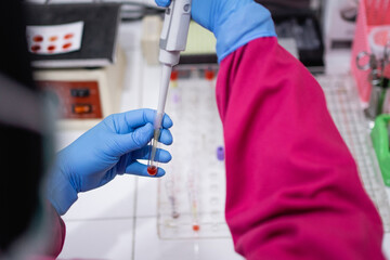 hands with rubber gloves using a pipette when inserting blood samples into a small tube for testing...