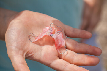 orthodontic plate for correcting an overbite on a boy's hand. close-up