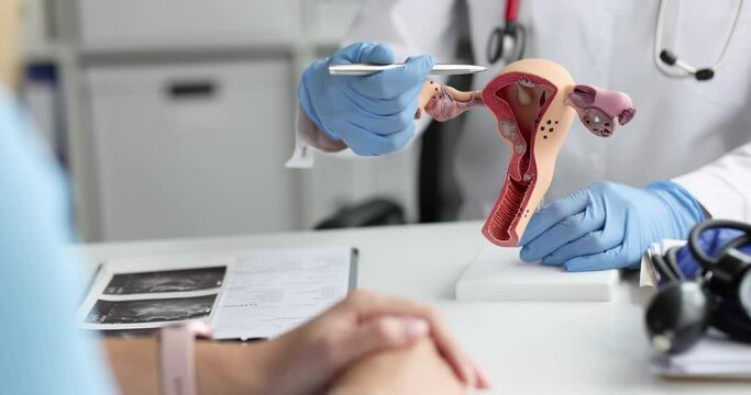 Doctor gynecologist explaining to woman patient female diseases on plastic model of uterus and ovaries in clinic 4k movie. Diagnostics and treatment of gynecological pathology concept