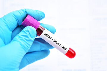 Blood sample for BRCA1 and BRCA2 test, gene marker for breast cancer