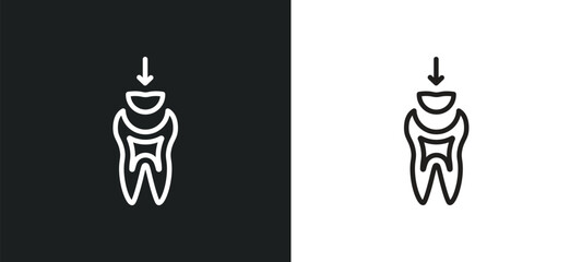 Fototapeta na wymiar dental filling outline icon in white and black colors. dental filling flat vector icon from dentist collection for web, mobile apps and ui.
