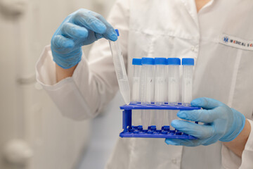hands of a nurse in blue medical gloves hold test tubes with biomaterial, laboratory tests, biopsy, DNA test