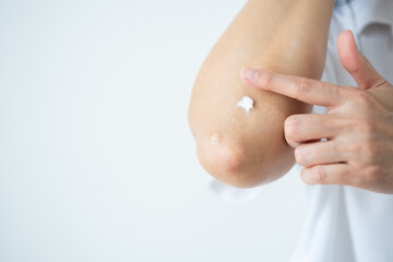 Asian woman applying cream on scarred elbow