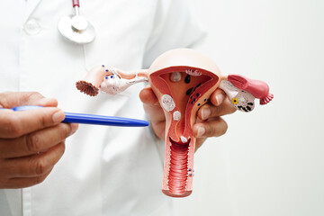 Uterus, doctor holding anatomy model for study diagnosis and treatment in hospital. - obrazy, fototapety, plakaty