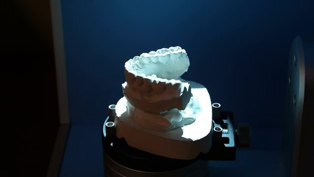 Scanning of the impression of the teeth for further printing on the printer. Dental prosthesis, dentures, prosthetics work.