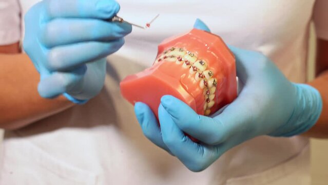 Close-up dentist hands in medical gloves hold plaster human jaw layout using plugger, describe therapy to patient. Oral hygiene orthodontic treatment