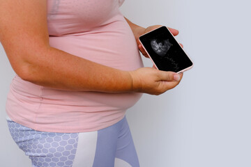pregnant woman holds mobile phone with ultrasound screen examination, small child rolls over in...