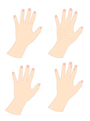 Obraz premium Rough hands woman3