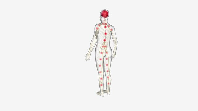 Central sensitization, the process by which the central nervous system processes pain and other sensory stimuli