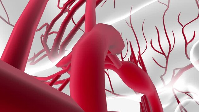 cerebral aneurysm is a weak or thin spot on an artery in the brain that balloons or bulges out and fills with blood