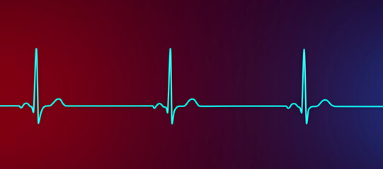 Electrocardiogram ECG displaying sinus bradycardia, 3D illustration