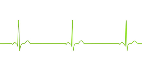 Electrocardiogram ECG displaying sinus bradycardia, 3D illustration