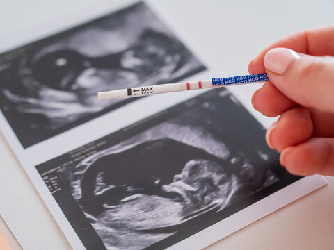 Woman holding a positive pregnancy test on the background of a photo with an ultrasound. 