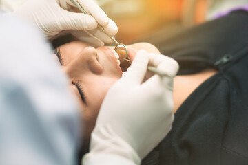 Oral and dental health care. Young woman lying with mouth wide open in dental chair for dentist to...