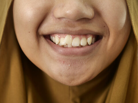 Asian muslim teenage girl smiling while looking at Camera, showing her crooked teeth