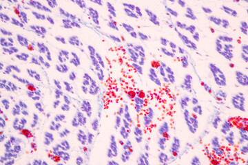 Showing Light micrograph of the Trachea, Thymus, Parathyroid gland and Tonsil  human under the microscope for education in the laboratory.