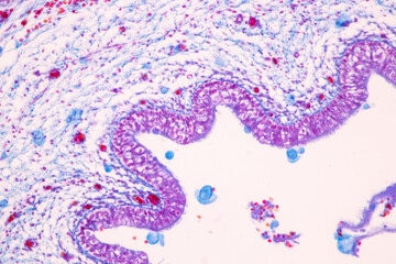 Showing Light micrograph of the Trachea, Thymus, Parathyroid gland and Tonsil  human under the microscope for education in the laboratory.
